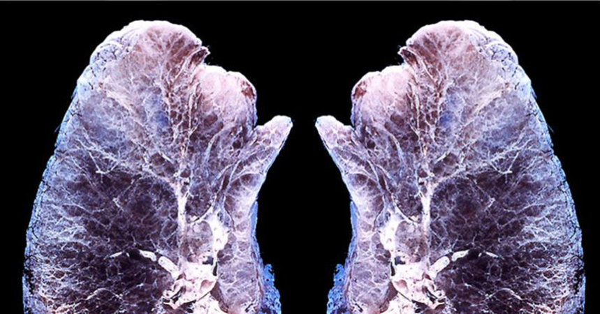 This Is What Happens to Your Lungs When You Diffuse Essential Oils