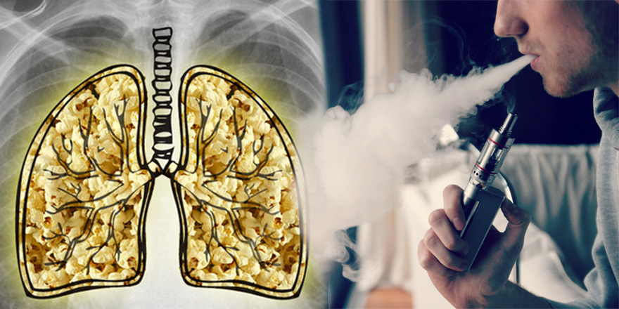 Why Vaping will not give you Popcorn Lung